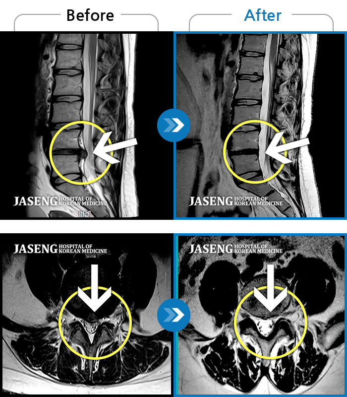 ؿڻѹ溴 ġ MRI  ġ-īο  .