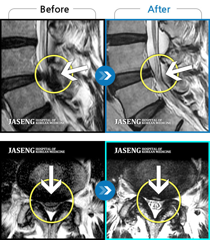 ؿڻѹ溴 ġ MRI  ġ- 㸮 Ƹ  ٸ  .