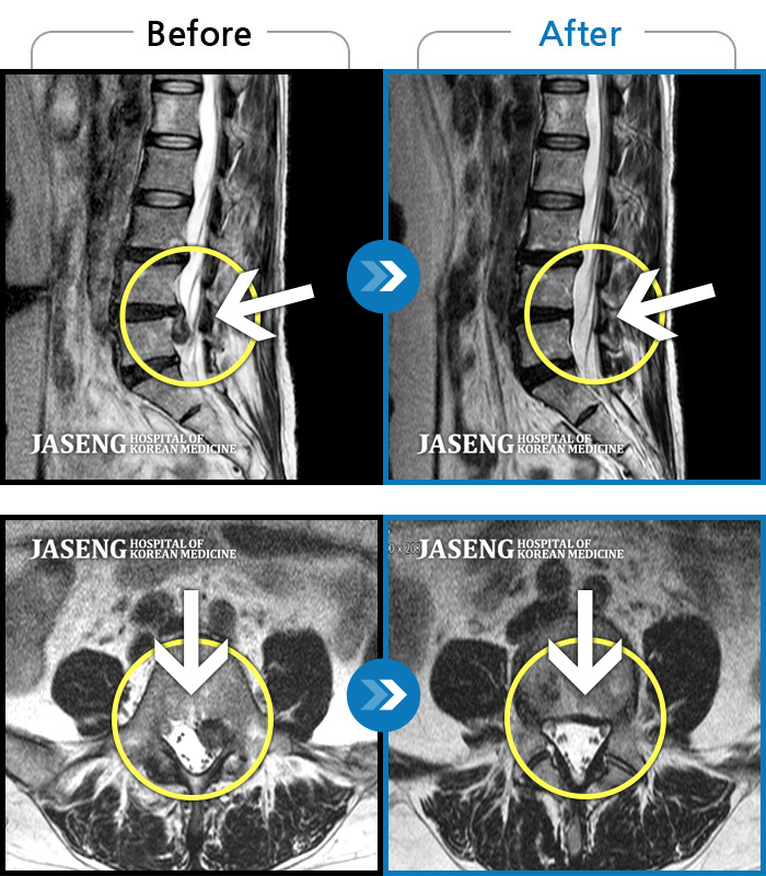 õڻѹ溴 ġ MRI  ġ-ä ϰ  ٸ  ȵ.