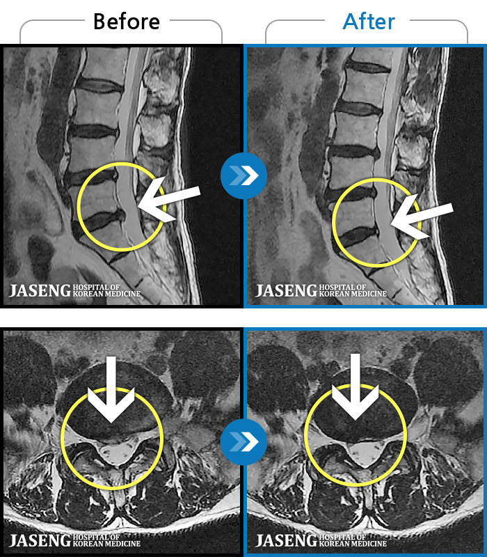 ڻѹ溴 ġ MRI  ġ-   ϰ     ӵǾϴ. ߰ Ͽ ߰   Ǵ  ߵ ̻  ȣϴ ¿ϴ.