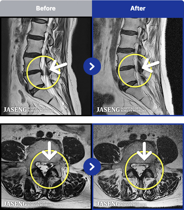 �����ڻ��ѹ溴�� ġ���� MRI�� ���� ġ����-���� �㸮, ��� ������ ���� ����� �� ��������, �߸� ���� �ٷ����Ϸ� �ϻ��Ȱ �Ұ���