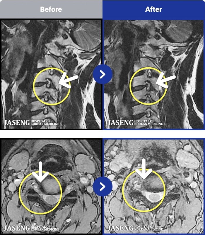 ���ڻ��ѹ溴�� ġ���� MRI�� ���� ġ����-�ð��� ������ �������� �ʴ� �������� ����