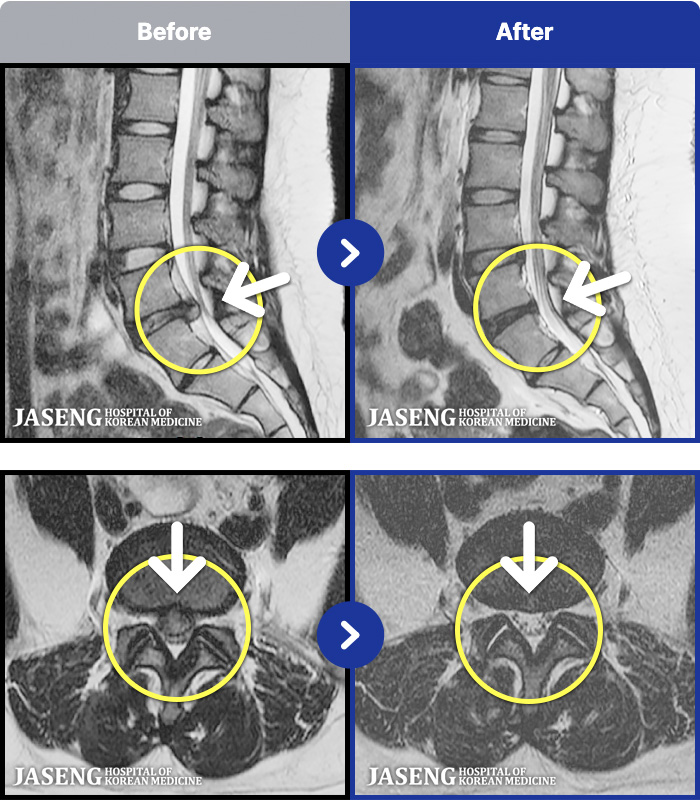 ��õ�ڻ��ѹ溴�� ġ���� MRI�� ���� ġ����-���� �� ���� ��������� ȣ���Ͽ� ���� �� ���������� ��ũ�� ������