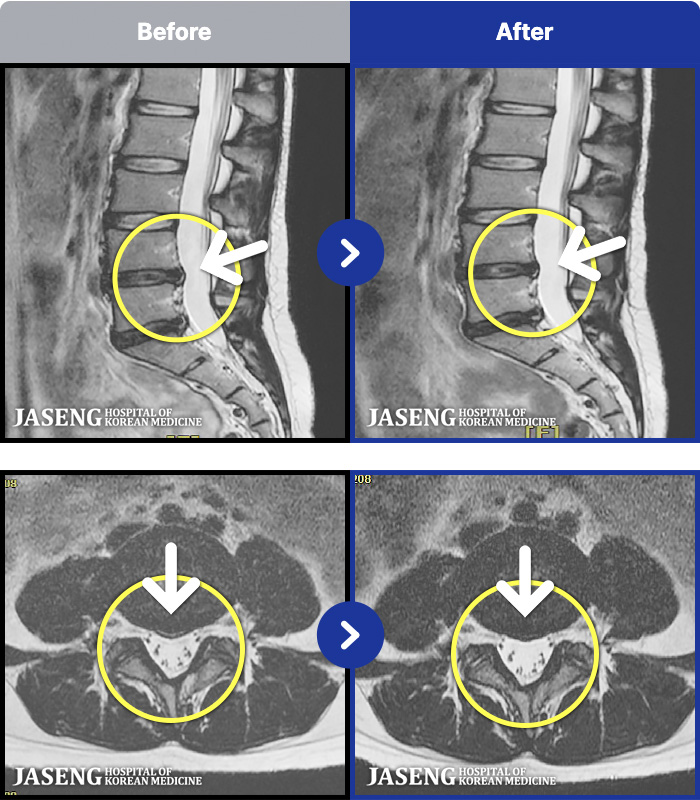 �ڻ��ѹ溴�� ġ���� MRI�� ���� ġ����-���� ��� �㸮 �Ʒ��ʿ� ������ ���� ������ �ȱ� ����� ���¿����ϴ�