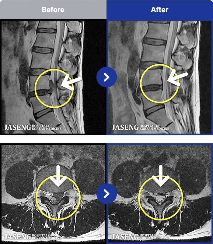 �ڻ��ѹ溴�� ġ���� MRI�� ���� ġ����-��ð� ���� �� ���� �ɾ� �ִ� ������ ���� �㸮��ũ�� �ߺ��Ͽ����ϴ�.
