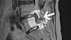 MRI  1