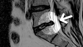 MRI ���� ���1