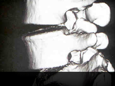 수원자생한방병원 허리질환 퇴행성디스크-정상척추에 관련된 이미지 입니다.