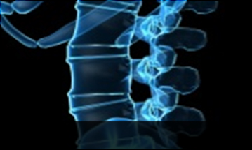 수원자생한방병원 허리질환 척추전방전위증-정상적인 사람의 척추뼈 모습입니다.